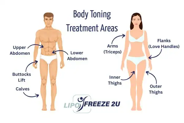 Graphic showing where you can have Body toning Treatment Maidstone on your body