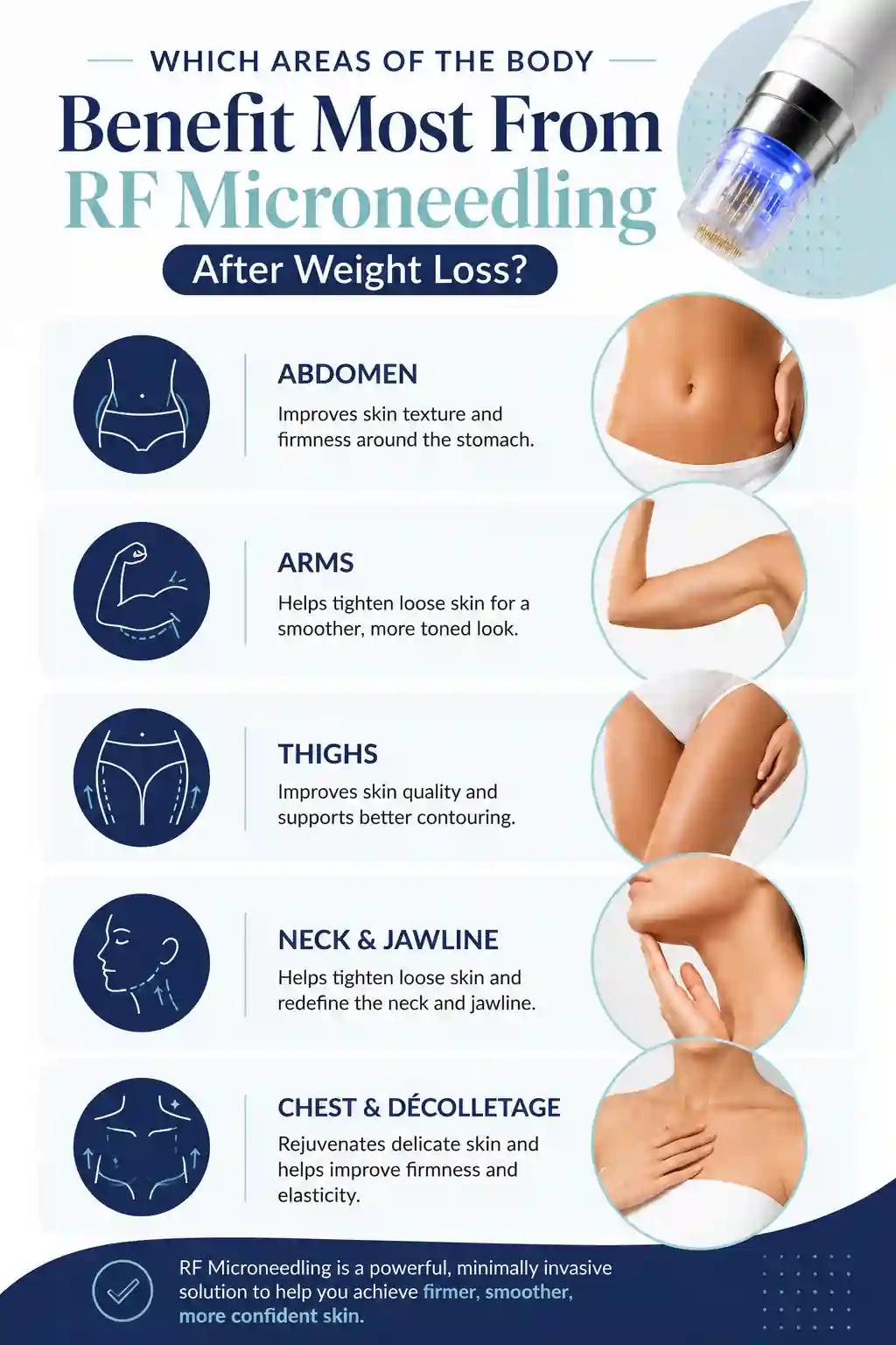 Which Areas of the Body Benefit Most From RF Microneedling After Weight Loss Maidstone